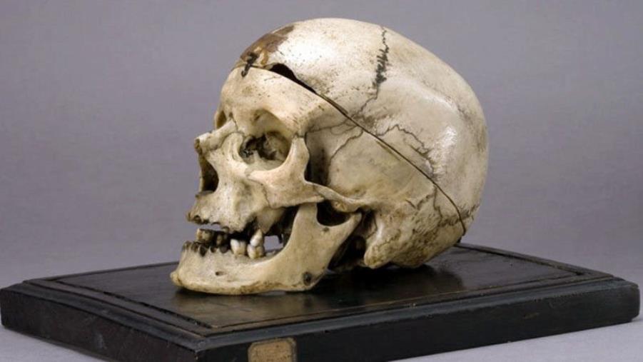 Cranio del Museo Lombroso. La Cassazione definì giusto conoscerne le teorie 