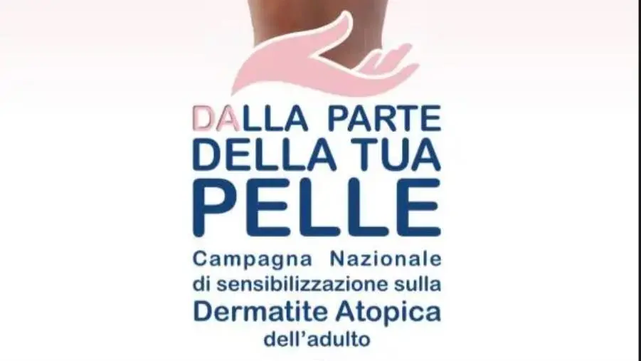 images Gli Open Day sulla dermatite atopica tornano in Calabria: consulti gratuiti a Catanzaro, Reggio e Cosenza