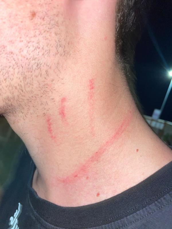 images Movida a Soverato, la denuncia di un giovane : "Io, scippato con violenza in discoteca"
